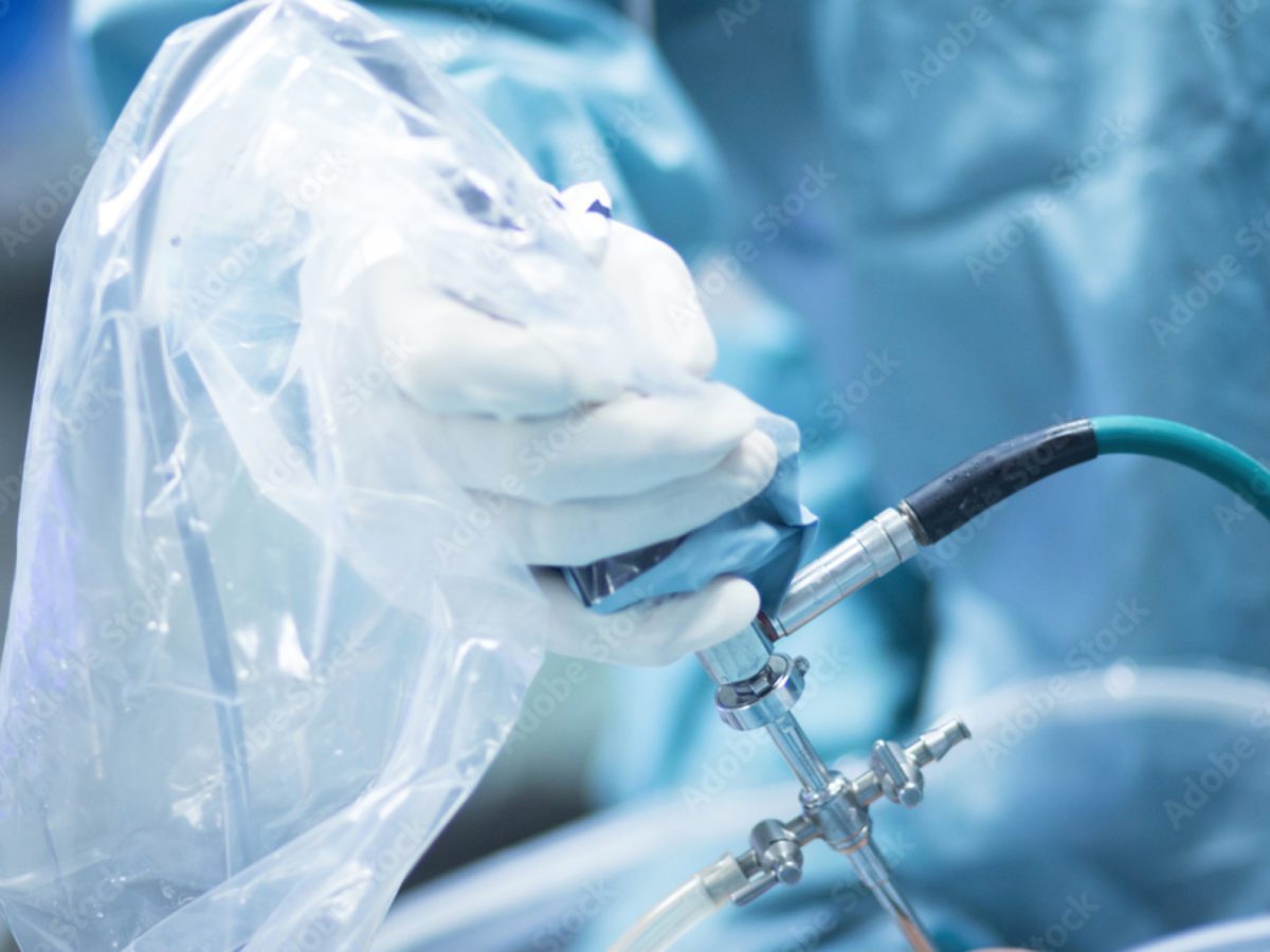 ambiente chirurgico che mostra un artroscopio