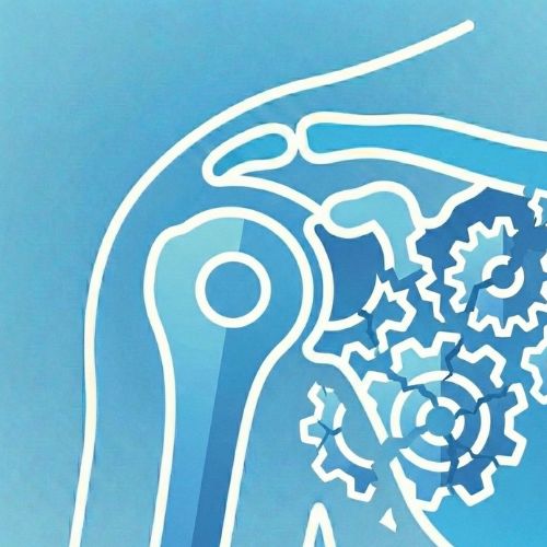 Illustrazione stilizzata di una spalla su sfondo azzurro; la zona della scapola è sostituita da una serie di ingranaggi meccanici scheggiati e disallineati, a simboleggiare un’alterazione del movimento e del ritmo scapolo-omerale.